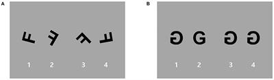 Brain Activation of Patients With Obsessive-Compulsive Disorder During a Mental Rotation Task: A Functional MRI Study